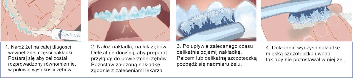 Zel Opalescence etapy